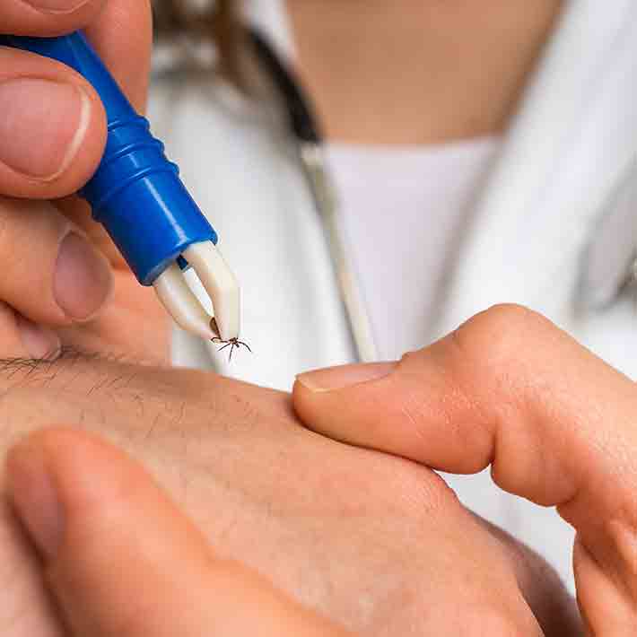 Zecken/FSME/Borreliose